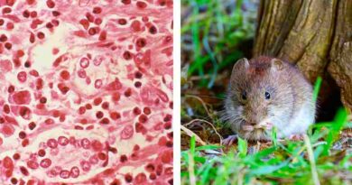 Despeja tus dudas por brote de hantavirus en un crucero